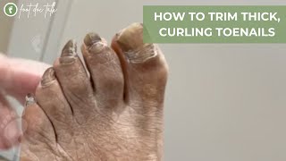 HOW TO TRIM THICK CURLING TOENAILS [upl. by Aihtenyc]