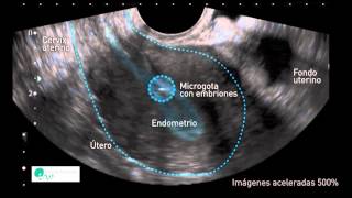 INSTITUT MARQUÈS  El útero mueve a los embriones para que se implanten correctamente [upl. by Annaicul985]