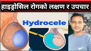 Hydrocele details in Nepali हाइड्रोसिल कसरी हुन्छ यसको लक्षण तथा औषधि उपचार कसरी गर्ने [upl. by Faith509]