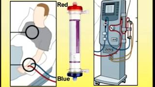 Setting Up of Dialysis Machine [upl. by Joelie917]