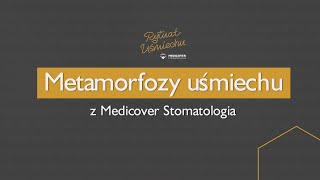 Metamorfozy uśmiechu z magazynem Claudia  Medicover Stomatologia [upl. by Aerdma]