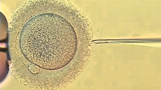 ICSI  Intra cytoplasmic Sperm Injection Treatment [upl. by Haelem488]