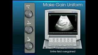 Clinical UltrasoundPhysics and Knobology [upl. by Pinckney]