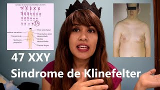 Sindrome de Klinefelter Trisomia 47 XXY [upl. by Seitz]