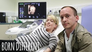 ‘UK’s Shortest Family’ Prepare For Second Baby  BORN DIFFERENT [upl. by Elkin]