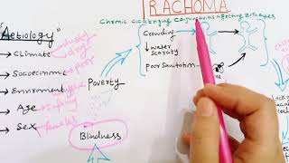 Trachoma  Pathogenesis Of Trachoma  conjunctivitis  ophthalmology  PART 01 [upl. by Minnie582]