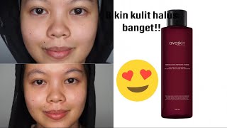 Review Avoskin Miraculous Refining Toner Selama 4 Minggu [upl. by Nira487]