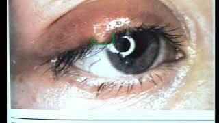 Floridas 20Hour Contact Lens Board Certification Webinar [upl. by Jermyn]