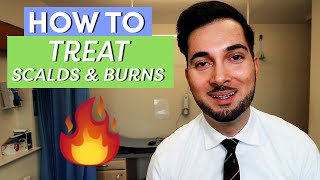 Burns  How To Treat Burns  How To Treat A Burn [upl. by Kra]