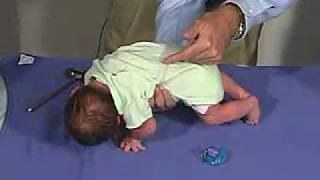 physical exam Newborn Normal Primitive Reflexes  Galant [upl. by Schilt]