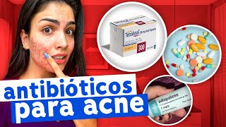 PRINCIPAIS ANTIBIÓTICOS PARA ACNE [upl. by Nicola]