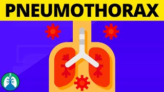 Signs of a Pneumothorax TMC Practice Question  Respiratory Therapy Zone [upl. by Roath]