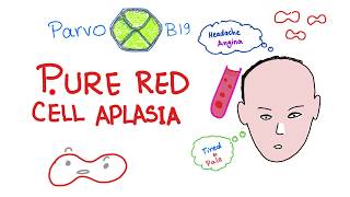 Pure Red Cell Aplasia PRCA  Hematology [upl. by Artinek]