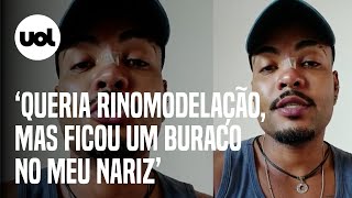 Fiquei com buraco no meu nariz Modelo de Curitiba relata problemas após procedimento [upl. by Skurnik]