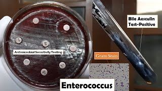 Enterococcus Antibiotics sensitivity testing bile esculin positive and Gram staining [upl. by Zeculon]