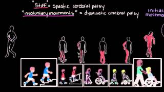 Khan Academy  Types of Cerebral Palsy Part 2 Dyskinetic amp Ataxic [upl. by Eanore]