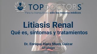 ¿Qué es la litiasis renal Conoce todos los detalles [upl. by Rezal]