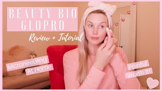 BEAUTY BIO GLOPRO Review  Tutorial  Painful Worth It [upl. by Kramnhoj]