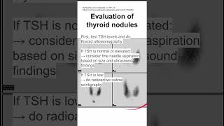 Evaluation of thyroid nodules [upl. by Hodgkinson]