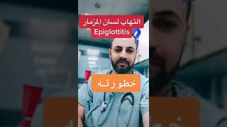 Epiglottitis التهاب لسان المزمار [upl. by Niawat52]