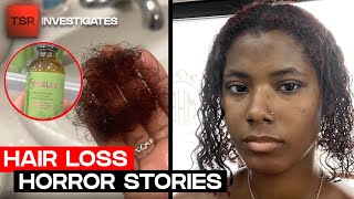 Mielle Organics UNDER FIRE After Consumers Claim Their Products Cause HAIR LOSS  TSR Investigates [upl. by Riamu]