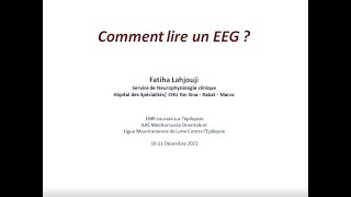 Comment lire un EEG [upl. by Nirre771]