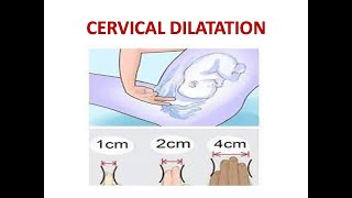 CERVICAL DILATATION [upl. by Anole]