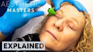 EXPLAINED Thermage Skin Tightening Treatment  London [upl. by Sudnac]