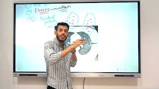 Lecture 5 Restrictive Lung disease tumors of lung diseases of pleura [upl. by Aissenav]