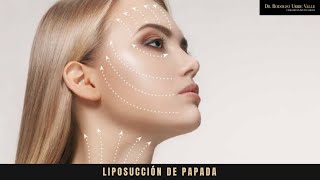 Antes de hacerte la Lipo de papada ¡Tienes que ver este vídeo [upl. by Paola]