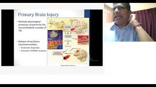 Rationalized Approach in the management Traumatic Brain Injury [upl. by Frager619]