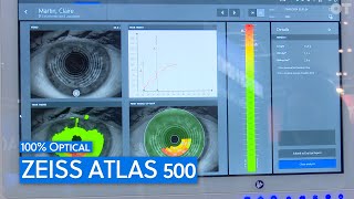 Four in one dry eye measurement device Zeiss Atlas 500 [upl. by Reiniar890]