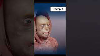 Face Transplant Surgery Animated Explanation [upl. by Arolf]