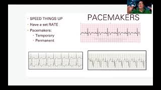 EKG Treating Dysrhythmias [upl. by Eimar]