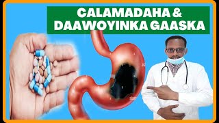 GAASKA CALOSHA amp MIDHICIRAHA CALAMALADAHA LAGU GARTO amp DAWEYNTISA PUPTIC ULCER DR MAHAMED LABAN [upl. by Malarkey514]