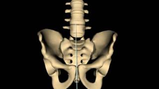 Superior Pubic Shear w Posterior Innominate Rotation [upl. by Akerehs]