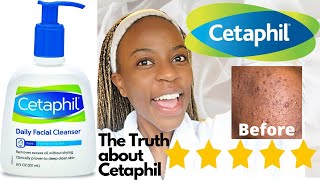 Cetaphil Skin Care Cleanser Review  Agnater [upl. by Anidnamra]