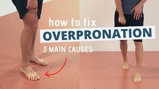 Pronated Feet and How to Fix 3 Different Causes of OVERPRONATION [upl. by Etnauj]