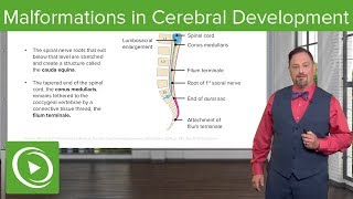 Malformations in Cerebellar Development – Embryology  Lecturio [upl. by Vashtee870]