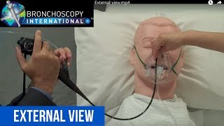 Flexible Bronchoscopy Basic Techniques 2  TBNA External View [upl. by Nickolas463]