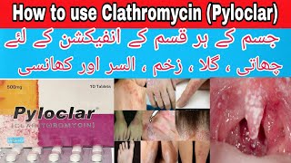 Clarithromycin 250mg and 500mg tablet UsePyloclarInfectionsDeewan medicineflue fever and cough [upl. by Midian]