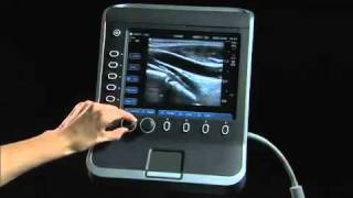 Sonosite S Series Product Training Part 1 System Overview [upl. by Antony]