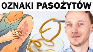 Objawy że pasożyty grasują w jelitach Jak je wygonić [upl. by Oneill44]