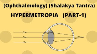 HYPERMETROPIA Part1 Ophthalmology Shalakya Tantra [upl. by Onin]