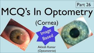 MCQ’s in Optometry  Cornea  Diseases of Cornea  Part 26 [upl. by Particia]