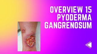 Overview 15  Pyoderma Gangrenosum [upl. by Ettennig142]