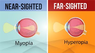 Ask the Optometrist  Guide to an Eyetest [upl. by Namyac190]