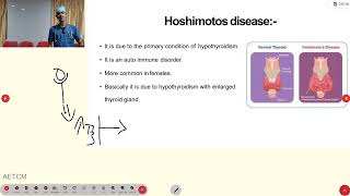 Hypothyroidism [upl. by Wise]