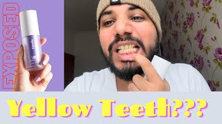 HiSmile v34 Colour Corrector Purple Toothpaste Review  Teeth Whitening and Scaling at Home [upl. by Hoffarth]