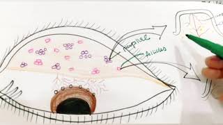 Trachoma  Stages Of Trachoma  Mac Callan Classification  clinical Features  conjunctivitis [upl. by Ignacia]